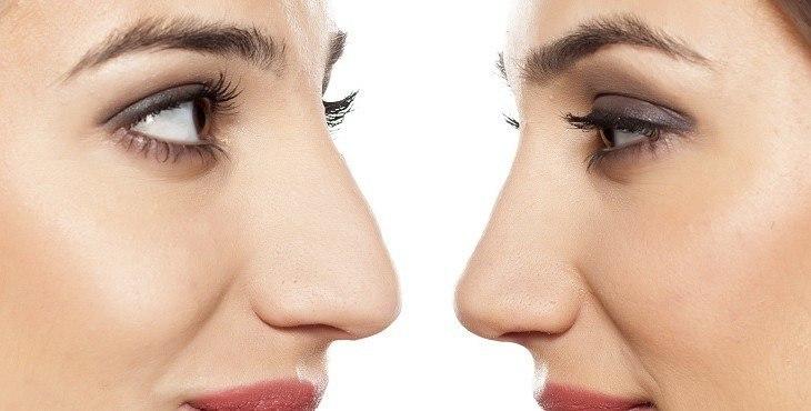 main image5fc934e857558