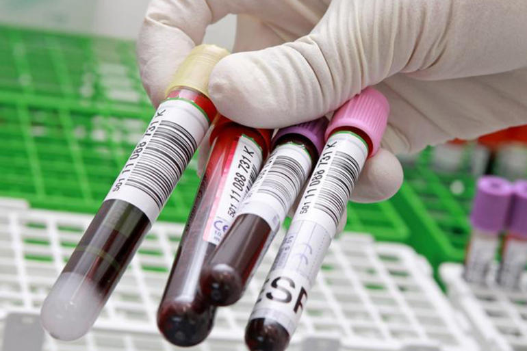 main image60919381e4fb1