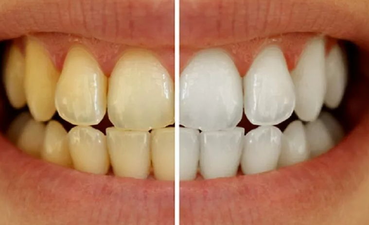 main image60f028a05b2f7