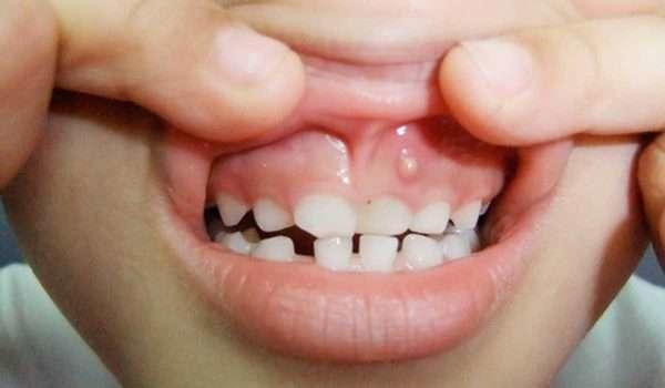 main image60f17791bf625