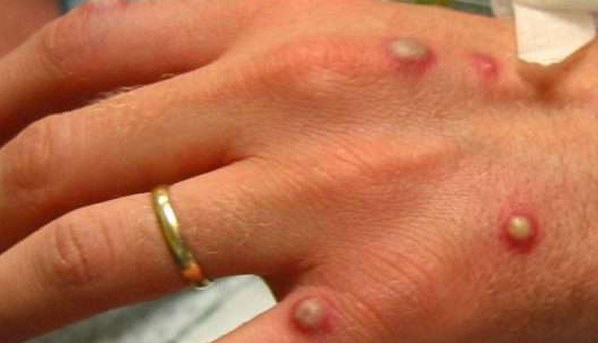 fe2ced2e e8c1 4b98 b1e5 5110d1e4ac3c